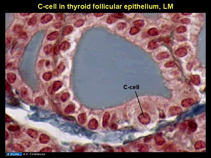 C-cell in thyroid follicular epithelium, LM C-cell A. K. Christensen 