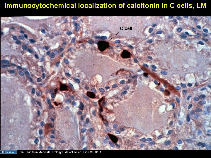 Immunocytochemical localization of calcitonin in C cells, LM C cell Stan Erlandsen Medical Histology