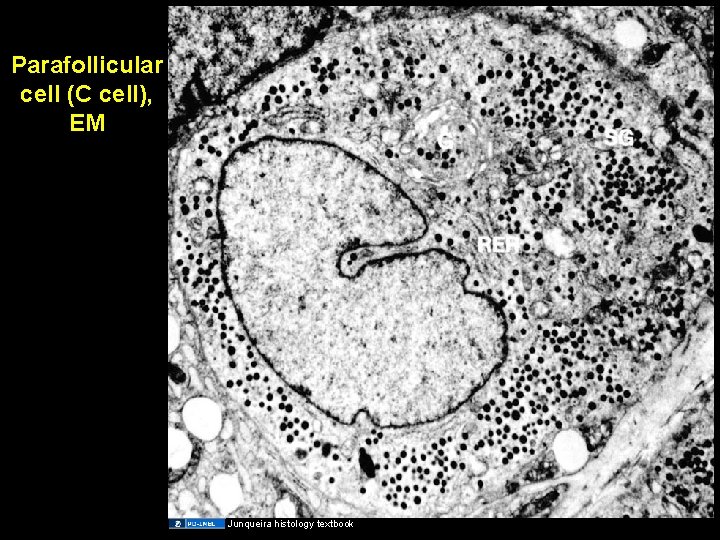 Parafollicular cell (C cell), EM Junqueira histology textbook 