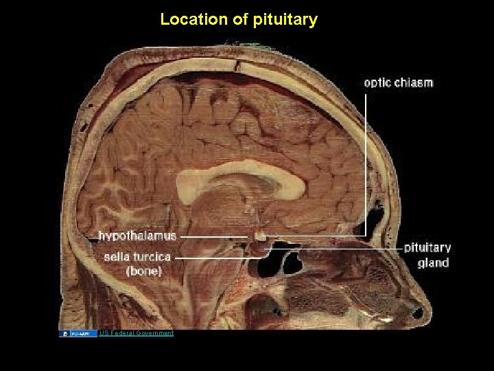 Location of pituitary US Federal Government 