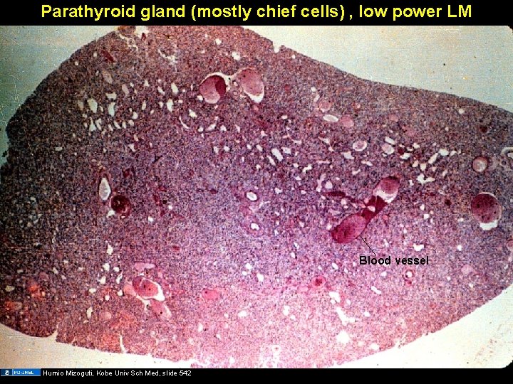 Parathyroid gland (mostly chief cells) , low power LM Blood vessel Humio Mizoguti, Kobe