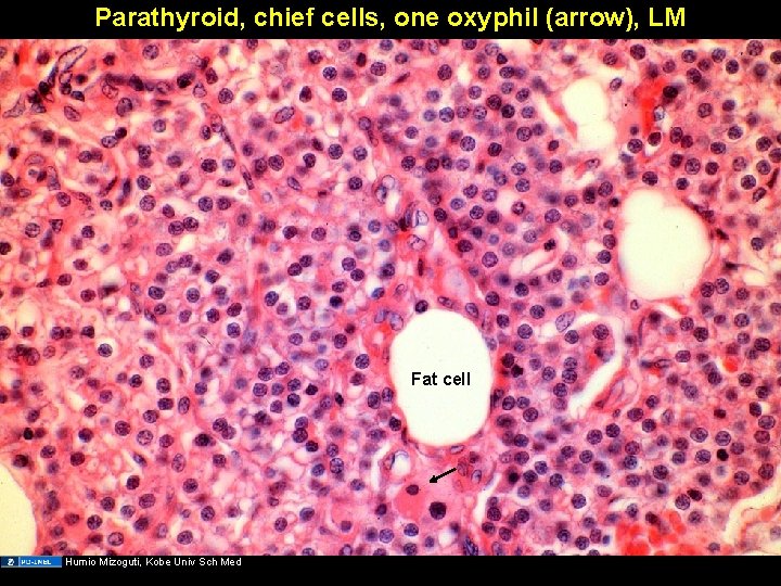 Parathyroid, chief cells, one oxyphil (arrow), LM Fat cell Humio Mizoguti, Kobe Univ Sch