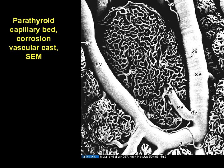 Parathyroid capillary bed, corrosion vascular cast, SEM Murakami et al 1987, Arch Hist Jap