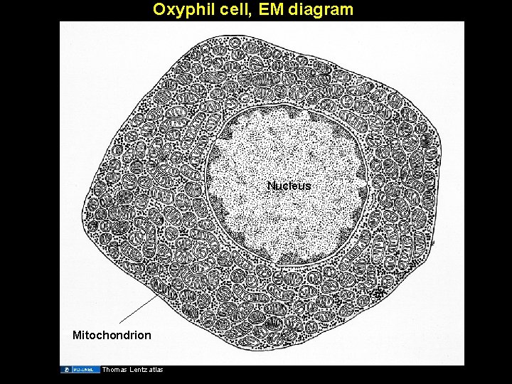 Oxyphil cell, EM diagram Nucleus Mitochondrion Thomas Lentz atlas 