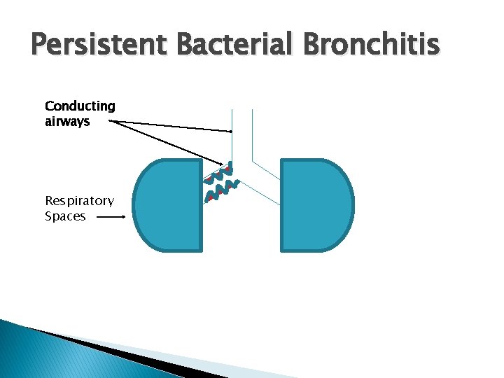 Persistent Bacterial Bronchitis Conducting airways Respiratory Spaces 