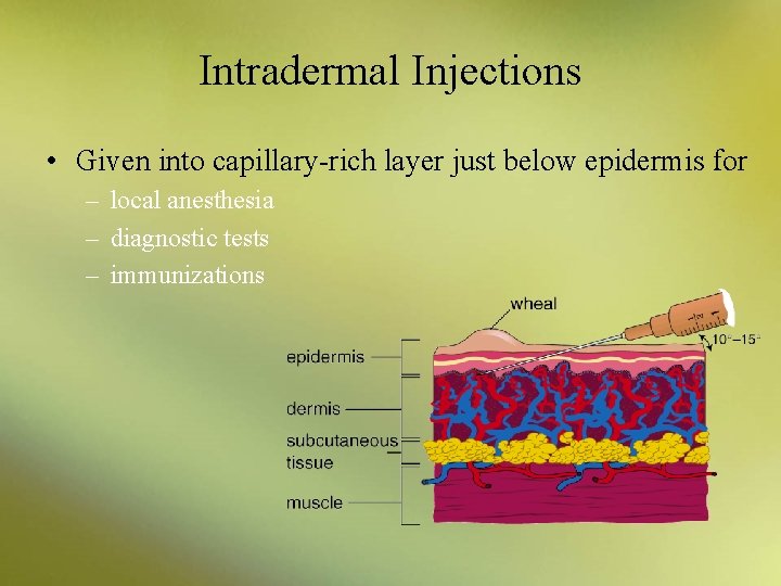 Intradermal Injections • Given into capillary-rich layer just below epidermis for – local anesthesia