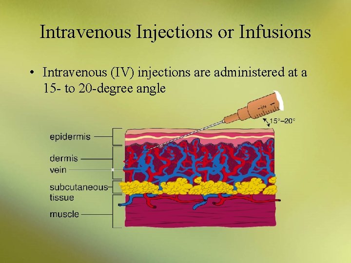 Intravenous Injections or Infusions • Intravenous (IV) injections are administered at a 15 -