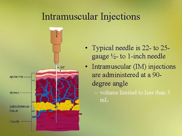 Intramuscular Injections • Typical needle is 22 - to 25 gauge ½- to 1