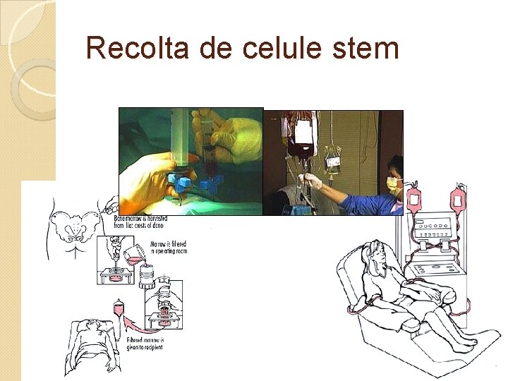 Recolta de celule stem 