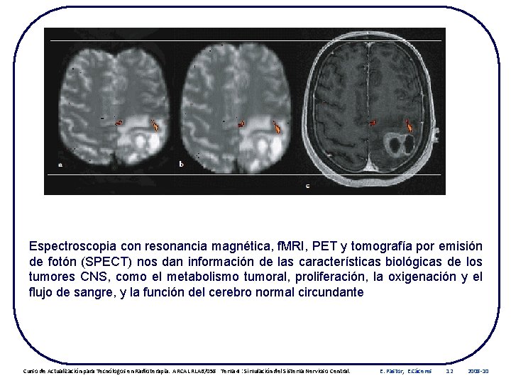 Espectroscopia con resonancia magnética, f. MRI, PET y tomografía por emisión de fotón (SPECT)