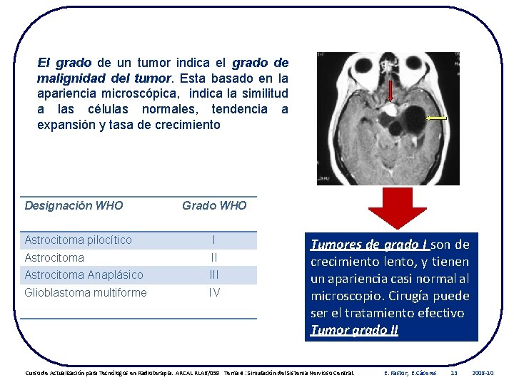 El grado de un tumor indica el grado de malignidad del tumor. Esta basado
