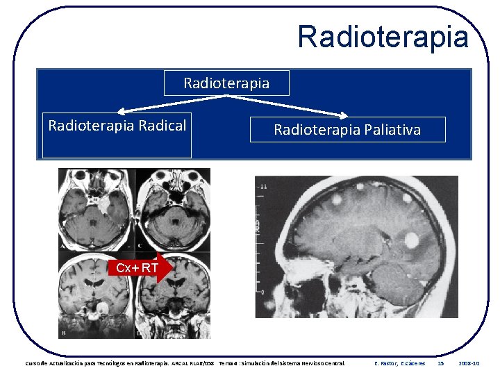 Radioterapia Radical Radioterapia Paliativa Cx+ RT Curso de Actualización para Tecnólogos en Radioterapia. ARCAL