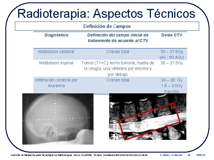 Radioterapia: Aspectos Técnicos Definición de Campos Diagnóstico Definición del campo inicial de tratamiento de