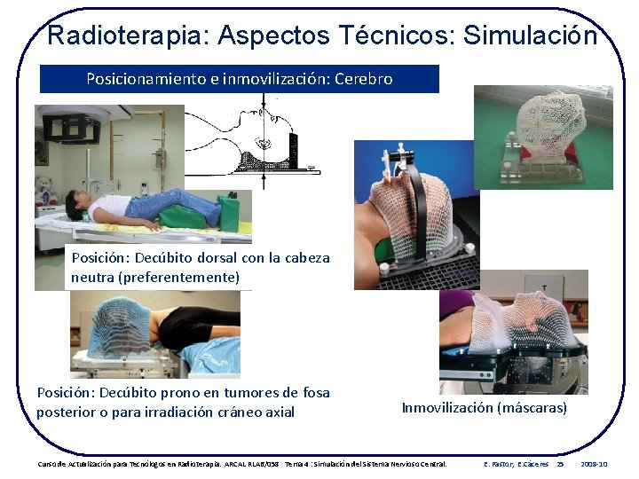 Radioterapia: Aspectos Técnicos: Simulación Posicionamiento e inmovilización: Cerebro Posición: Decúbito dorsal con la cabeza