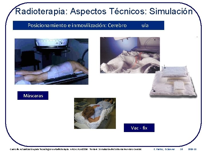 Radioterapia: Aspectos Técnicos: Simulación Posicionamiento e inmovilización: Cerebro Médula Máscaras Vac - fix Curso