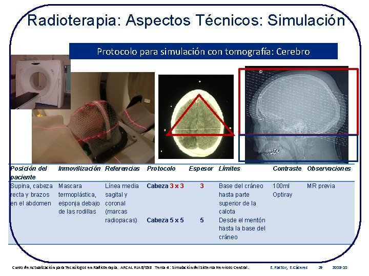 Radioterapia: Aspectos Técnicos: Simulación Protocolo para simulación con tomografía: Cerebro Posición del paciente Supina,