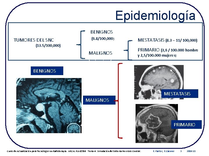 Epidemiología BENIGNOS TUMORES DEL SNC (6. 8/100, 000) (13. 5/100, 000) MALIGNOS (7. 3/100,