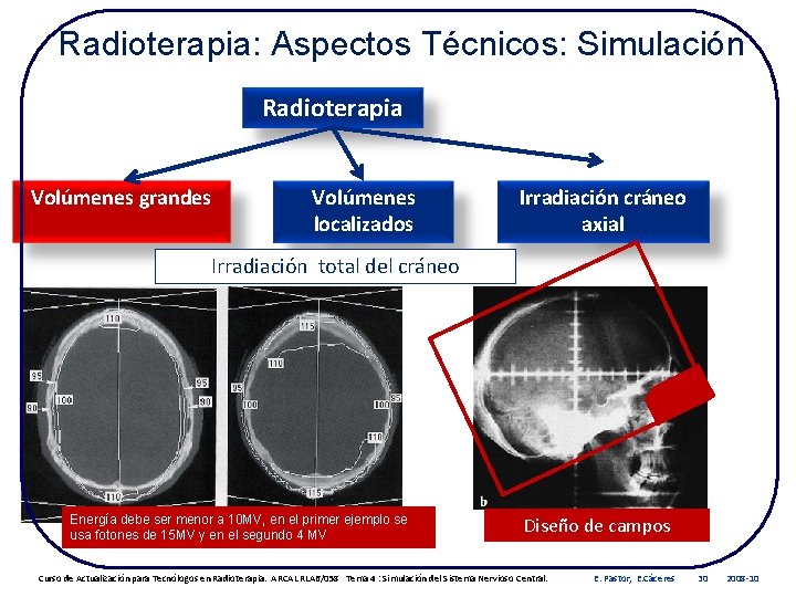 Radioterapia: Aspectos Técnicos: Simulación Radioterapia Volúmenes grandes Volúmenes localizados Irradiación cráneo axial Irradiación total