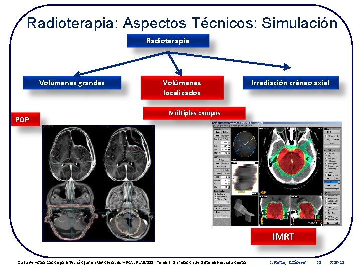 Radioterapia: Aspectos Técnicos: Simulación Radioterapia Volúmenes grandes POP Volúmenes localizados Irradiación cráneo axial Múltiples