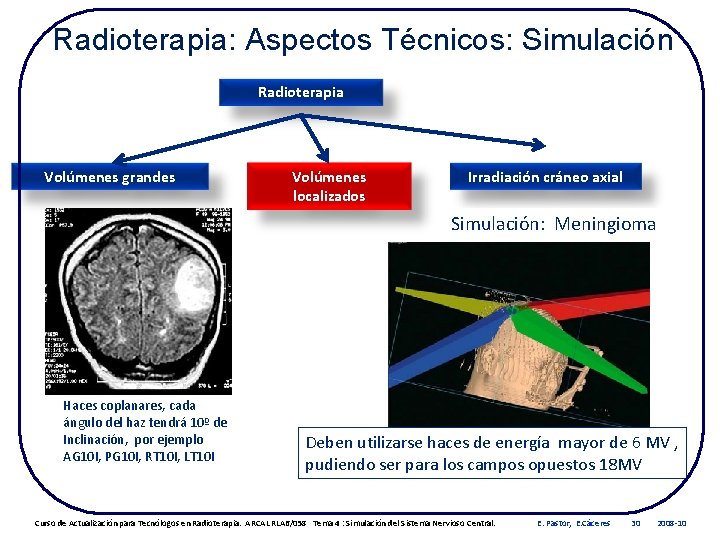 Radioterapia: Aspectos Técnicos: Simulación Radioterapia Volúmenes grandes Volúmenes localizados Irradiación cráneo axial Simulación: Meningioma