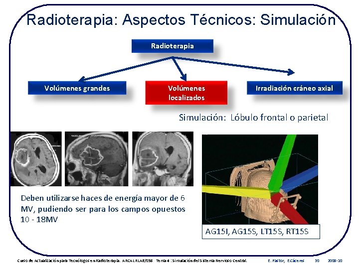 Radioterapia: Aspectos Técnicos: Simulación Radioterapia Volúmenes grandes Volúmenes localizados Irradiación cráneo axial Simulación: Lóbulo