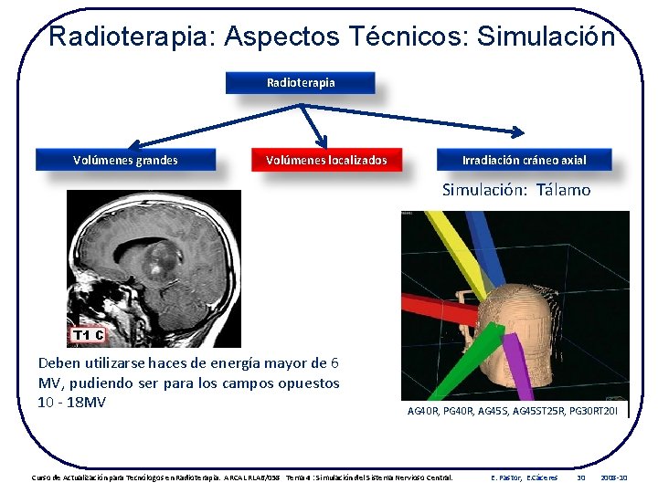 Radioterapia: Aspectos Técnicos: Simulación Radioterapia Volúmenes grandes Volúmenes localizados Irradiación cráneo axial Simulación: Tálamo