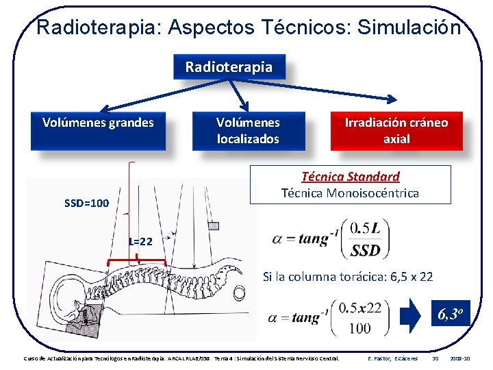 Radioterapia: Aspectos Técnicos: Simulación Radioterapia Volúmenes grandes Volúmenes localizados Irradiación cráneo axial Técnica Standard
