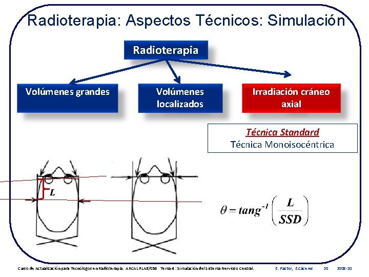 Radioterapia: Aspectos Técnicos: Simulación Radioterapia Volúmenes grandes Volúmenes localizados Irradiación cráneo axial Técnica Standard