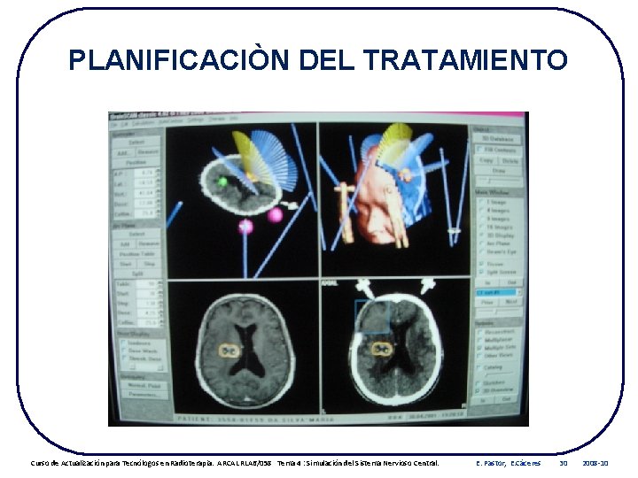 PLANIFICACIÒN DEL TRATAMIENTO Curso de Actualización para Tecnólogos en Radioterapia. ARCAL RLA 6/058 Tema