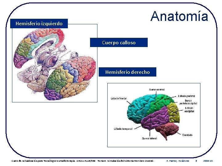 Anatomía Hemisferio izquierdo Cuerpo calloso Hemisferio derecho Curso de Actualización para Tecnólogos en Radioterapia.