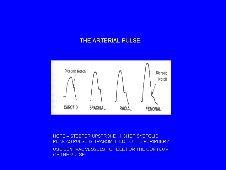 THE ARTERIAL PULSE NOTE – STEEPER UPSTROKE, HIGHER SYSTOLIC PEAK AS PULSE IS TRANSMITTED