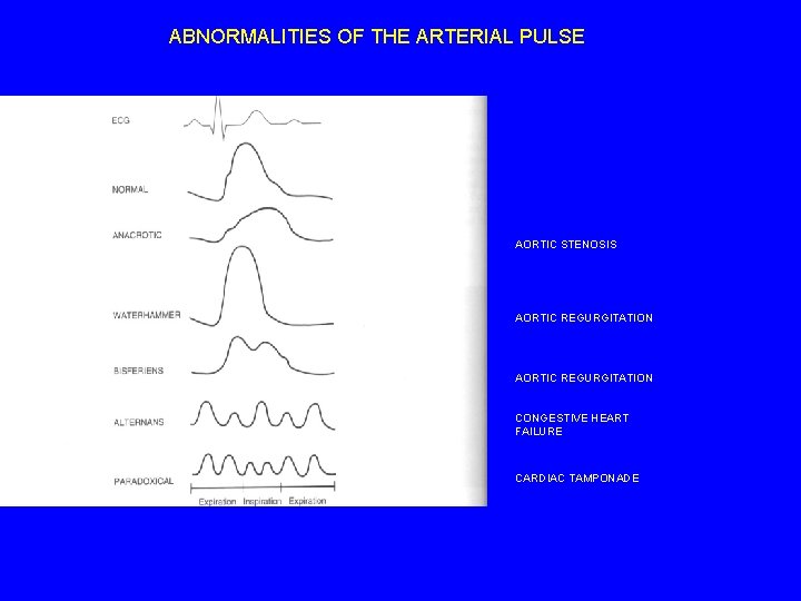 ABNORMALITIES OF THE ARTERIAL PULSE AORTIC STENOSIS AORTIC REGURGITATION CONGESTIVE HEART FAILURE CARDIAC TAMPONADE