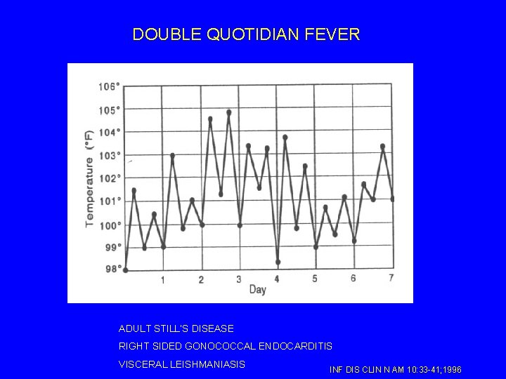 DOUBLE QUOTIDIAN FEVER ADULT STILL’S DISEASE RIGHT SIDED GONOCOCCAL ENDOCARDITIS VISCERAL LEISHMANIASIS INF DIS