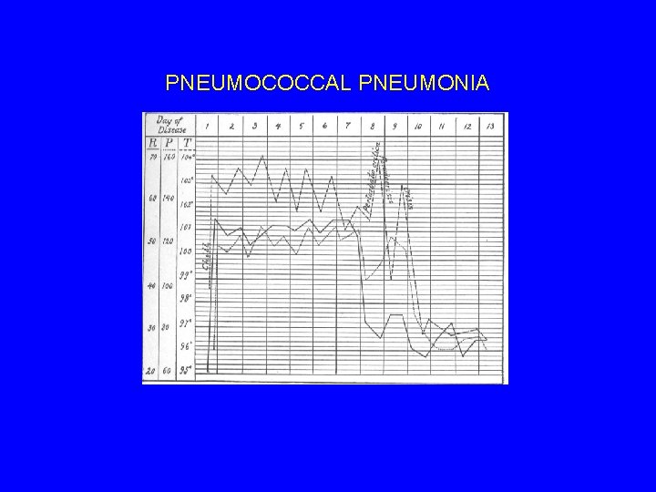 PNEUMOCOCCAL PNEUMONIA 