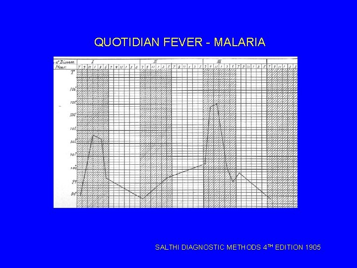 QUOTIDIAN FEVER - MALARIA SALTHI DIAGNOSTIC METHODS 4 TH EDITION 1905 