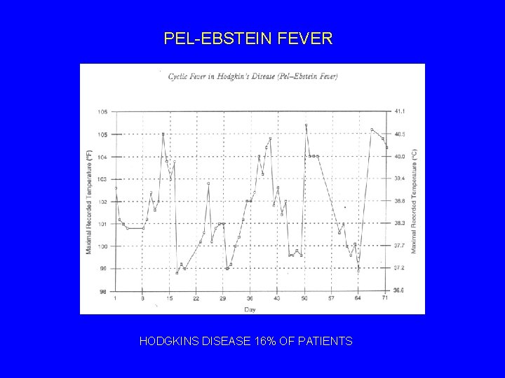 PEL-EBSTEIN FEVER HODGKINS DISEASE 16% OF PATIENTS 