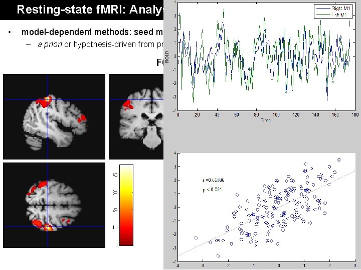 Resting-state f. MRI: Analysis • model-dependent methods: seed method – a priori or hypothesis-driven Resting-state f. MRI: Analysis • model-dependent methods: seed method – a priori or hypothesis-driven