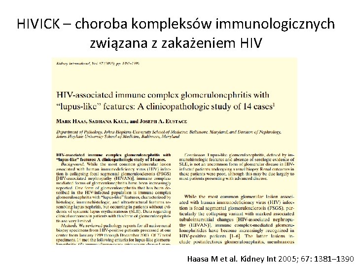 HIVICK – choroba kompleksów immunologicznych związana z zakażeniem HIV Haasa M et al. Kidney