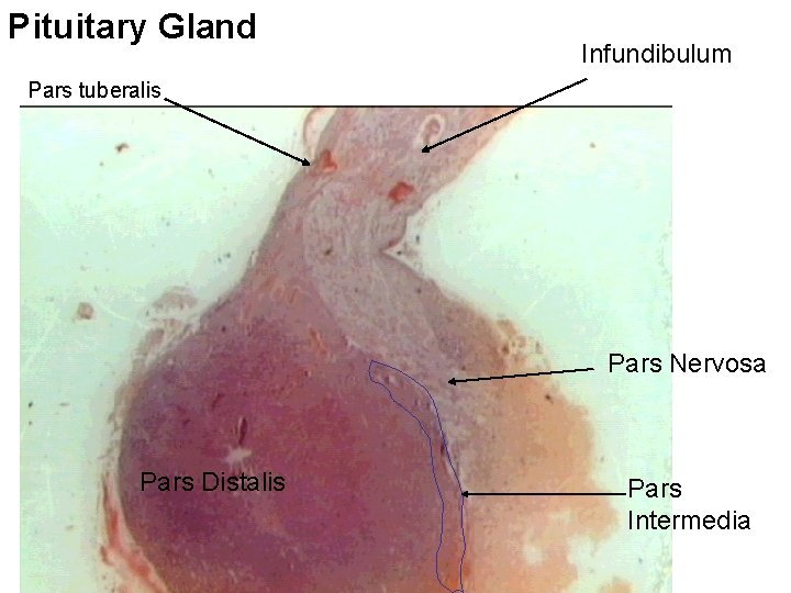 Pituitary Gland Infundibulum Pars tuberalis Pars Nervosa Pars Distalis Pars Intermedia 