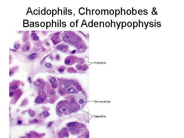 Acidophils, Chromophobes & Basophils of Adenohypophysis 