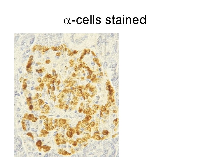 a-cells stained 