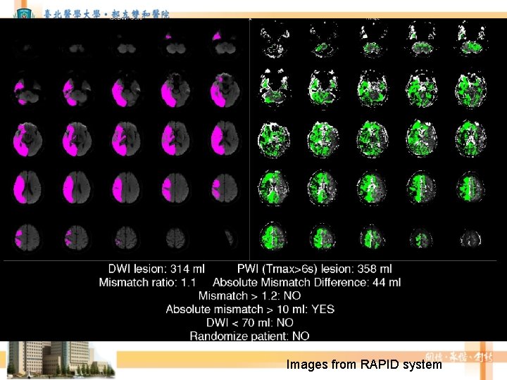 Images from RAPID system Images from RAPID system