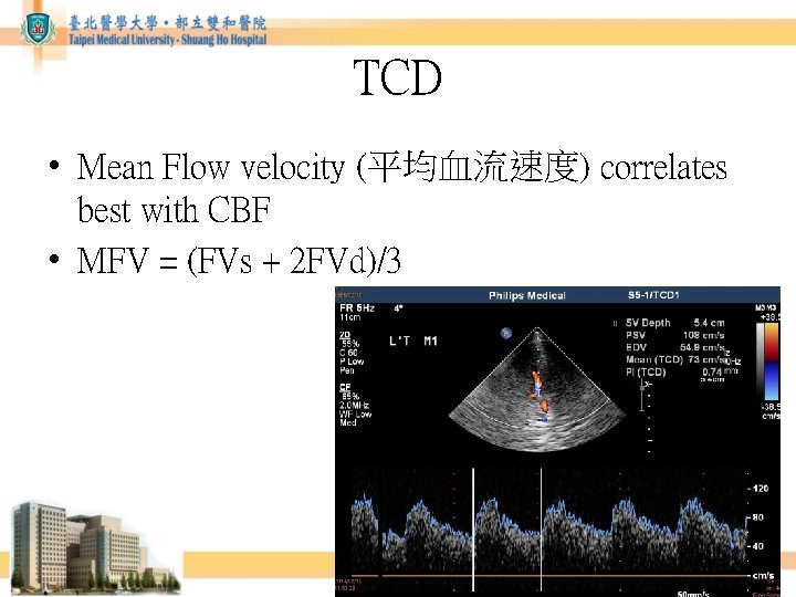 TCD • Mean Flow velocity (平均血流速度) correlates best with CBF • MFV = (FVs TCD • Mean Flow velocity (平均血流速度) correlates best with CBF • MFV = (FVs