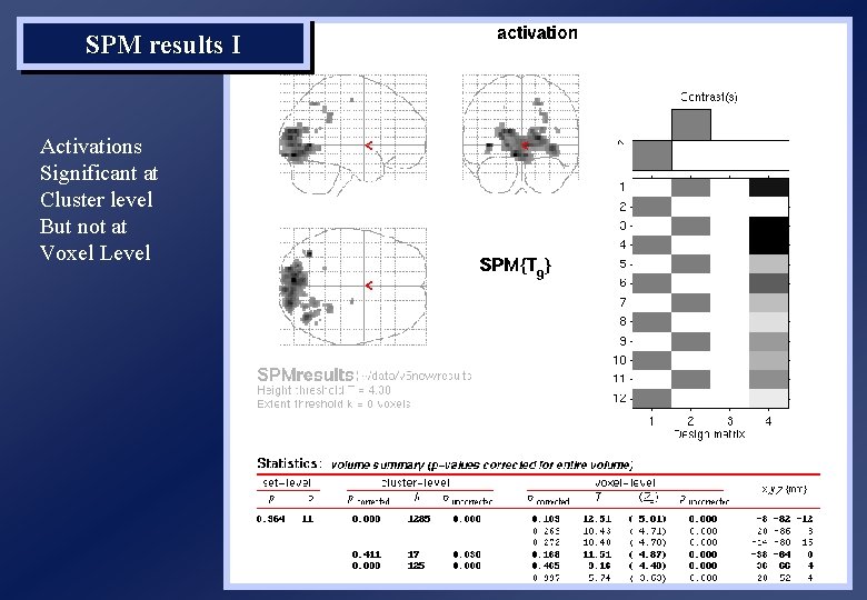 SPM results I Activations Significant at Cluster level But not at Voxel Level 
