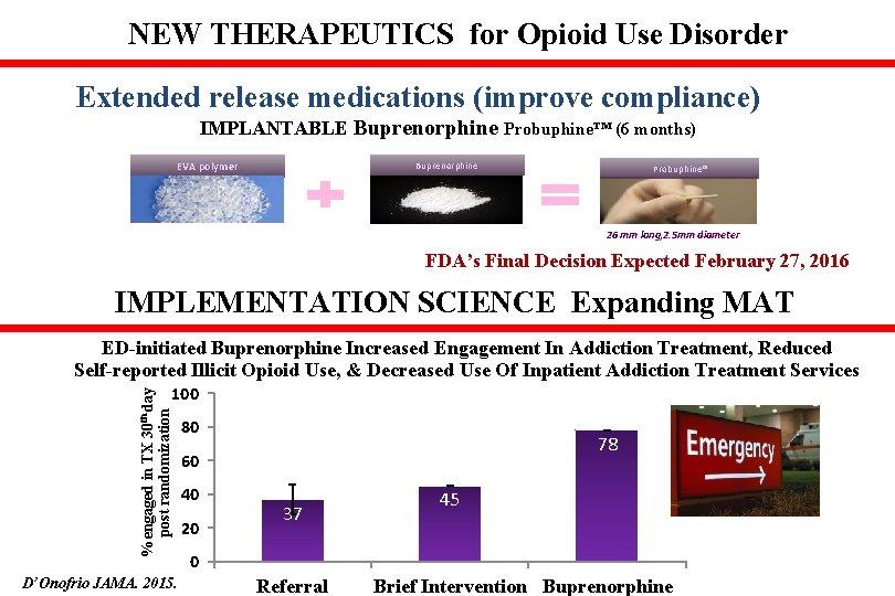 NEW THERAPEUTICS for Opioid Use Disorder Extended release medications (improve compliance) IMPLANTABLE Buprenorphine Probuphine™