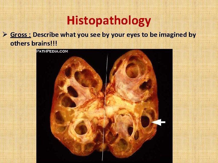 Histopathology Ø Gross : Describe what you see by your eyes to be imagined