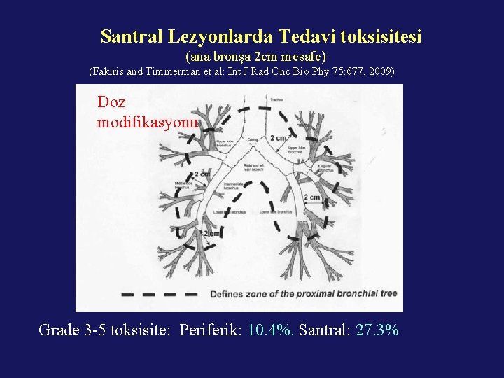 Santral Lezyonlarda Tedavi toksisitesi (ana bronşa 2 cm mesafe) (Fakiris and Timmerman et al: