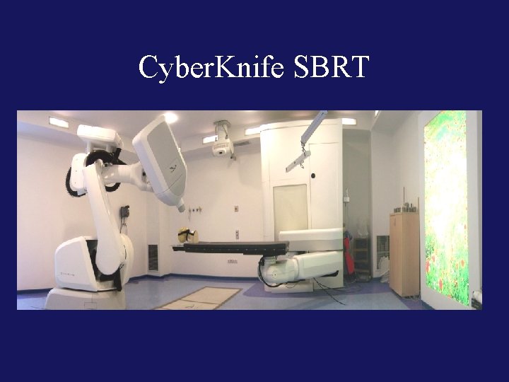 Cyber. Knife SBRT 