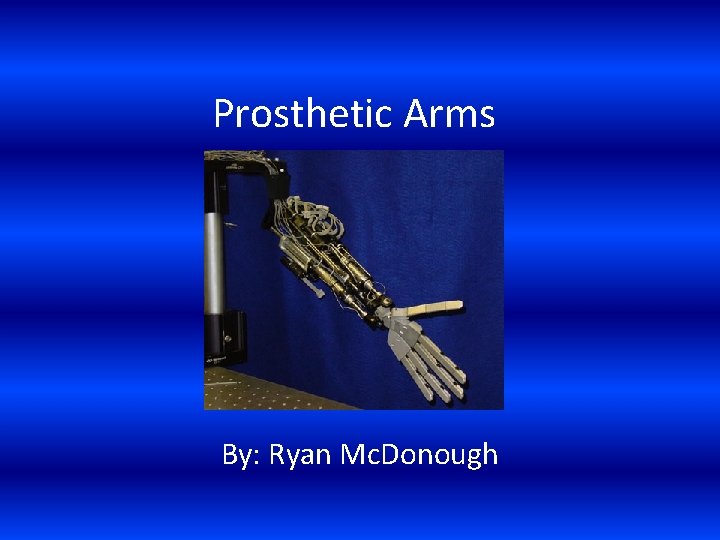 Prosthetic Arms By: Ryan Mc. Donough 