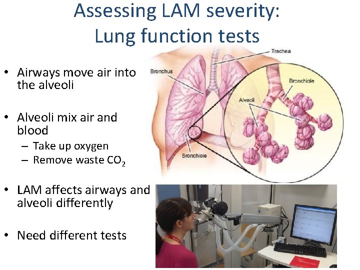 Assessing LAM severity: Lung function tests • Airways move air into the alveoli •